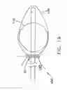 Fig. 20 - Apparatus and method for the ligation of tissue