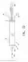 Fig. 34 - Apparatus and method for the ligation of tissue