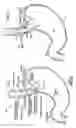 Fig. 02 - Tissue fixation assemblies having a plurality of fasteners ready for serial deployment