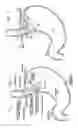 Fig. 02 - Tissue fixation assemblies providing single stroke deployment
