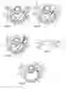 Fig. 06 - System and devices for the repair of a vertebral disc defect