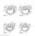Fig. 07 - System and devices for the repair of a vertebral disc defect