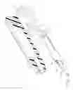 Fig. 09 - Sheath for enabling insertion and extraction of anastomotic ring applier