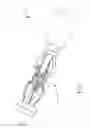 Fig. 02 - Surgical instrument for extracting an anastomotic ring device