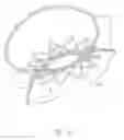 Fig. 05 - Surgical instrument for extracting an anastomotic ring device