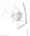 Fig. 09 - Surgical instrument for extracting an anastomotic ring device