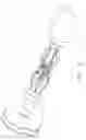 Fig. 03 - Sheathless anastomotic ring applier device