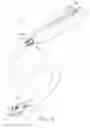 Fig. 07 - Sheathless anastomotic ring applier device