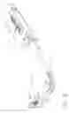Fig. 06 - Articulating anastomotic ring applier