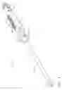 Fig. 02 - Anastomotic ring applier device providing forward and retrograde visualization