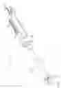 Fig. 06 - Anastomotic ring applier device providing forward and retrograde visualization
