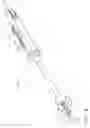 Fig. 07 - Anastomotic ring applier device providing forward and retrograde visualization