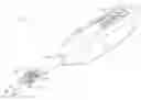 Fig. 01 - Anastomotic ring applier with double motion actuation