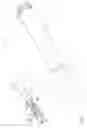 Fig. 02 - Screw tip control for anastomotic ring applier