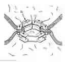 Fig. 01 - Endoluminal gastric ring and method