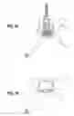 Fig. 14 - Endoluminal gastric ring and method