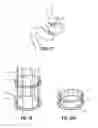 Fig. 15 - Endoluminal gastric ring and method
