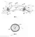 Fig. 02 - Apparatus and method of using an occluder for embolic protection