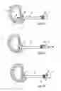 Fig. 13 - System and devices for the repair of a vertebral disc defect