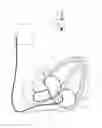 Fig. 06 - Devices and methods for detecting and treating inadequate tissue perfusion