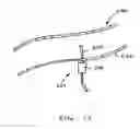 Fig. 07 - Devices and methods for detecting and treating inadequate tissue perfusion