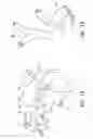 Fig. 10 - Method and apparatus for controlling autonomic balance using neural stimulation