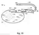 Fig. 19 - Closed loop cardiac resynchronization therapy using cardiac activation sequence information