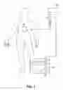 Fig. 02 - Method and device for electrochemical rejuvenation of skin and underlying tissue, and muscle building