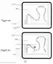 Fig. 05 - Patient training routine for biological interface system