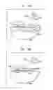 Fig. 17 - Dermatological treatment device with deflector optic