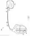 Fig. 02 - Cable electrode assembly for a lead terminal and method therefor
