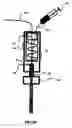 Fig. 04 - Intramural needle-tipped surgical device