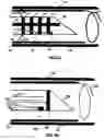 Fig. 05 - Intramural needle-tipped surgical device