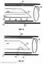 Fig. 06 - Intramural needle-tipped surgical device