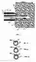 Fig. 08 - Intramural needle-tipped surgical device