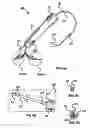 Fig. 11 - Intramural needle-tipped surgical device