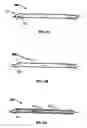 Fig. 14 - Intramural needle-tipped surgical device