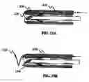 Fig. 16 - Intramural needle-tipped surgical device