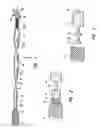 Fig. 02 - System for the controlled delivery of stents and grafts