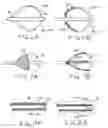 Fig. 04 - Apparatus and methods for renal stenting