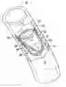 Fig. 01 - Medical valve leaflet structures with peripheral region receptive to tissue ingrowth