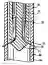 Fig. 01 - Artificial valve