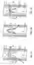 Fig. 03 - Artificial valve