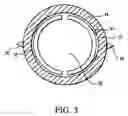 Fig. 04 - Artificial valve