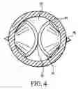 Fig. 05 - Artificial valve