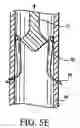 Fig. 09 - Artificial valve