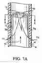 Fig. 11 - Artificial valve