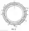 Fig. 13 - Artificial valve