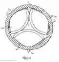 Fig. 14 - Artificial valve