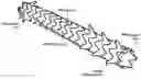 Fig. 01 - Removeable stents